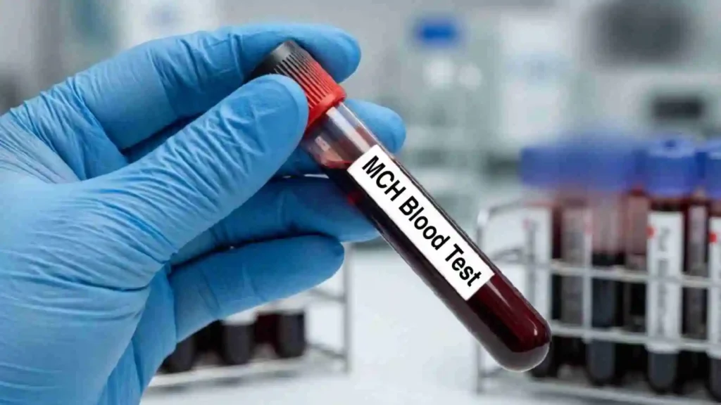 MCH Blood Test 4 mchc blood test